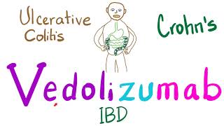 Management of Inflammatory Bowel Disease IBD Crohns and Ulcerative Colitis [upl. by Percy]