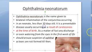 Ophthalmology Neonatal Conjunctivitis Ophthalmia Neonatorum Causes Eye Discharge in Baby Newborn [upl. by Audi]