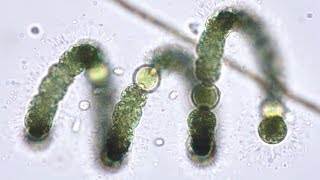 Bluegreen Algae Cyanobacteria from Pond to Lab  Pondlife Episode 2 [upl. by Piselli]