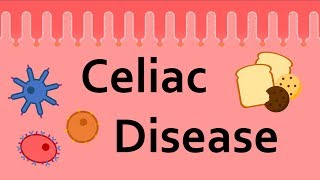 Your Health Celiac Disease [upl. by Nerty326]