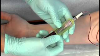 Sample Procedure  Venipuncture Butterfly Method [upl. by Pippas191]