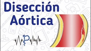 74º Curso de Cardiologia  Dissecção de aorta [upl. by Neibart]