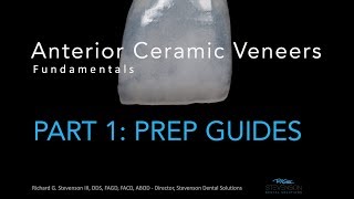 Anterior Ceramic Veneers Part 1 Preparation Guides [upl. by Lashar982]