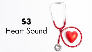 S3 Heart Sound  MEDZCOOL [upl. by Nyloj161]