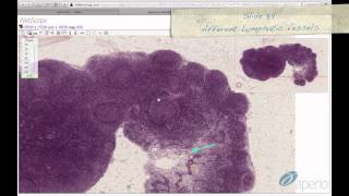 Histology Helper  Lymphoid Tissue Histology [upl. by Derick]