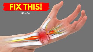 How to Fix Wrist Pain for Good [upl. by Eniamraj]