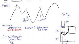 CVP Tracing [upl. by Anwat988]