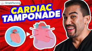 Cardiac Tamponade NCLEX Tips for Nursing Students [upl. by Nahtnaoj126]