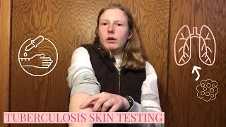 WHAT TO EXPECT AT A TB TUBERCULOSIS SKIN TEST  MY EXPERIENCE 💉 [upl. by Lana]