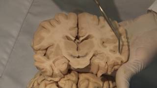 Basic Parts of the Brain  Part 1  3D Anatomy Tutorial [upl. by Leuname]