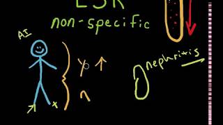 ESR Blood Test Erythrocyte Sedimentation Rate [upl. by Narad]