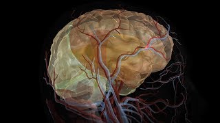 Stroke Education  Causes and Effects [upl. by Niknar]