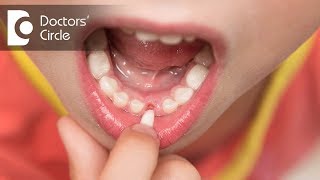 Why do childrens teeth fall out  Dr Raju Srinivas [upl. by Belloir647]