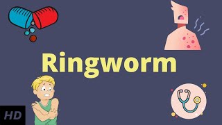 Ringworm Causes Signs and Symptoms Diagnosis and Treatment [upl. by Conlon]