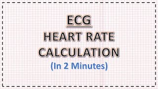 READING AND INTERPRETING A FETAL HEART RATE MONITOR [upl. by Nowell]