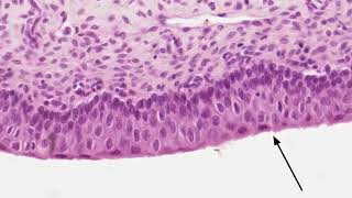 Histology of the Urinary Bladder [upl. by Nerrej]