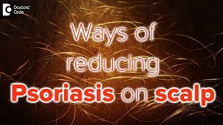 What helps psoriasis on scalp  Dr Rasya Dixit [upl. by Auqenet]