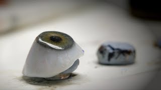 How Prosthetic Eyes Are Made And Fitted [upl. by Mannie]