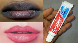 How to get pink lips naturally permanently with toothpaste at home [upl. by Bonilla]