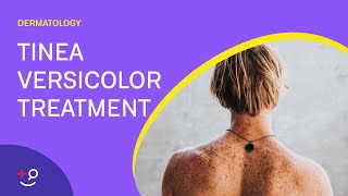 How To Treat Tinea Versicolor [upl. by Seth408]