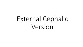 External Cephalic Version  Obstetrics [upl. by Varien392]