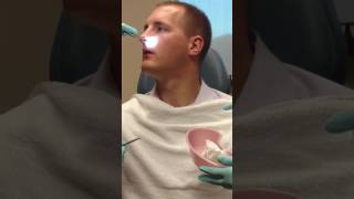 Septoplasty and Turbinate Reduction Splint Removal [upl. by Urbannal862]