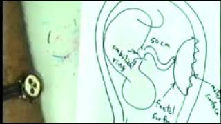 General Embryology 08  End  Embryo 8  Dr Sameh Ghazy [upl. by Lajet]