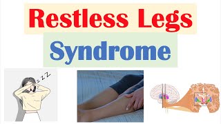 Restless Legs Syndrome RLS  Causes Signs amp Symptoms Diagnosis Treatment [upl. by Eliason]