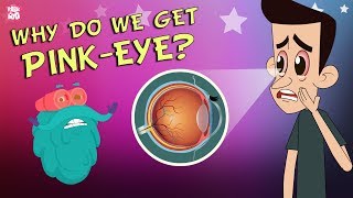 What Causes Conjunctivitis  CONJUNCTIVITIS  PinkEye  The Dr Binocs Show  Peekaboo Kidz [upl. by Ostler]