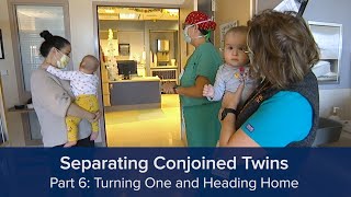 Separating Conjoined Twins Part 6 Turning One and Heading Home [upl. by Hotze]