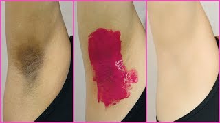 How To Lighten Dark Underarms PERMANENTLY  100 Naturally  Anaysa [upl. by Airyt]