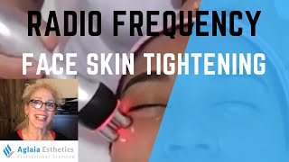 Microneedling with Secret RF [upl. by Dranyar]