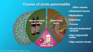 Acute Pancreatitis [upl. by Sankey]