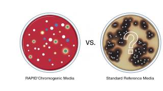 RAPIDChromogenic Media Solutions [upl. by Sauer]