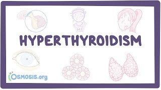 3 Easy Ways to Help Thyroid Work Correctly [upl. by Ahsinar]