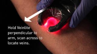 Veinlite LED Vein Finder Demo [upl. by Nylecyoj]