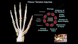 Flexor Tendon Injuries  Everything You Need To Know  Dr Nabil Ebraheim [upl. by Hanimay376]