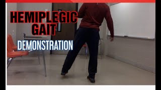 HEMIPLEGIC GAITGAIT DEMONSTRATION [upl. by Aimehs]