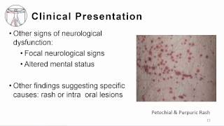 An overview of Herpes Simplex Encephalitis [upl. by Lothar]