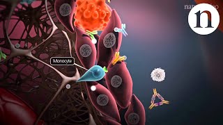 Using Methotrexate  Megans Story Medac Films 2011 [upl. by Nylarad791]