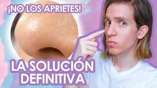 COMO ELIMINAR los FILAMENTOS SEBACEOS  Recomendaciones de un dermatologo [upl. by Rosita]