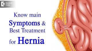 What is Hernia Symptoms Causes Types Treatment  Dr Harish N S  Doctors Circle [upl. by Jarrell583]