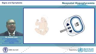 Neonatal Hypoglycemia [upl. by Petua]