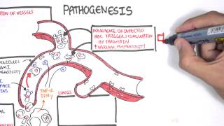 Malaria Pathophysiology [upl. by Renick537]