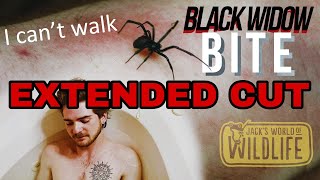 Black Widow BITE The EXTENDED CUT [upl. by Magdalene]