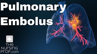 How to Pronounce Hemorrhagic CORRECTLY [upl. by Leandro]