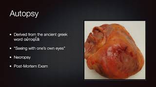 PathElective introduction to Autopsy [upl. by Ynohta338]