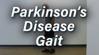 My Parkinsons Story Advanced Parkinsons [upl. by Asserat256]