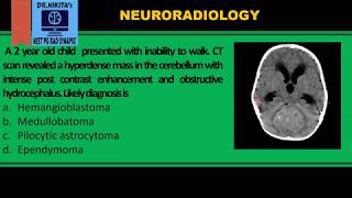 Medulloblastoma II CTMRI findings [upl. by Yerggoeg687]