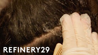 I Got A Scalp Facial To Treat Dandruff  Macro Beauty  Refinery29 [upl. by Aicercal]